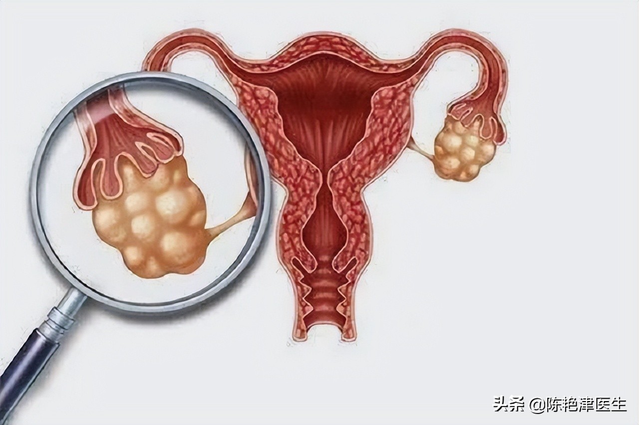 年轻妈妈妊娠纹严重的肚子照片,13岁女孩肚子爬满妊娠纹吓到妈妈