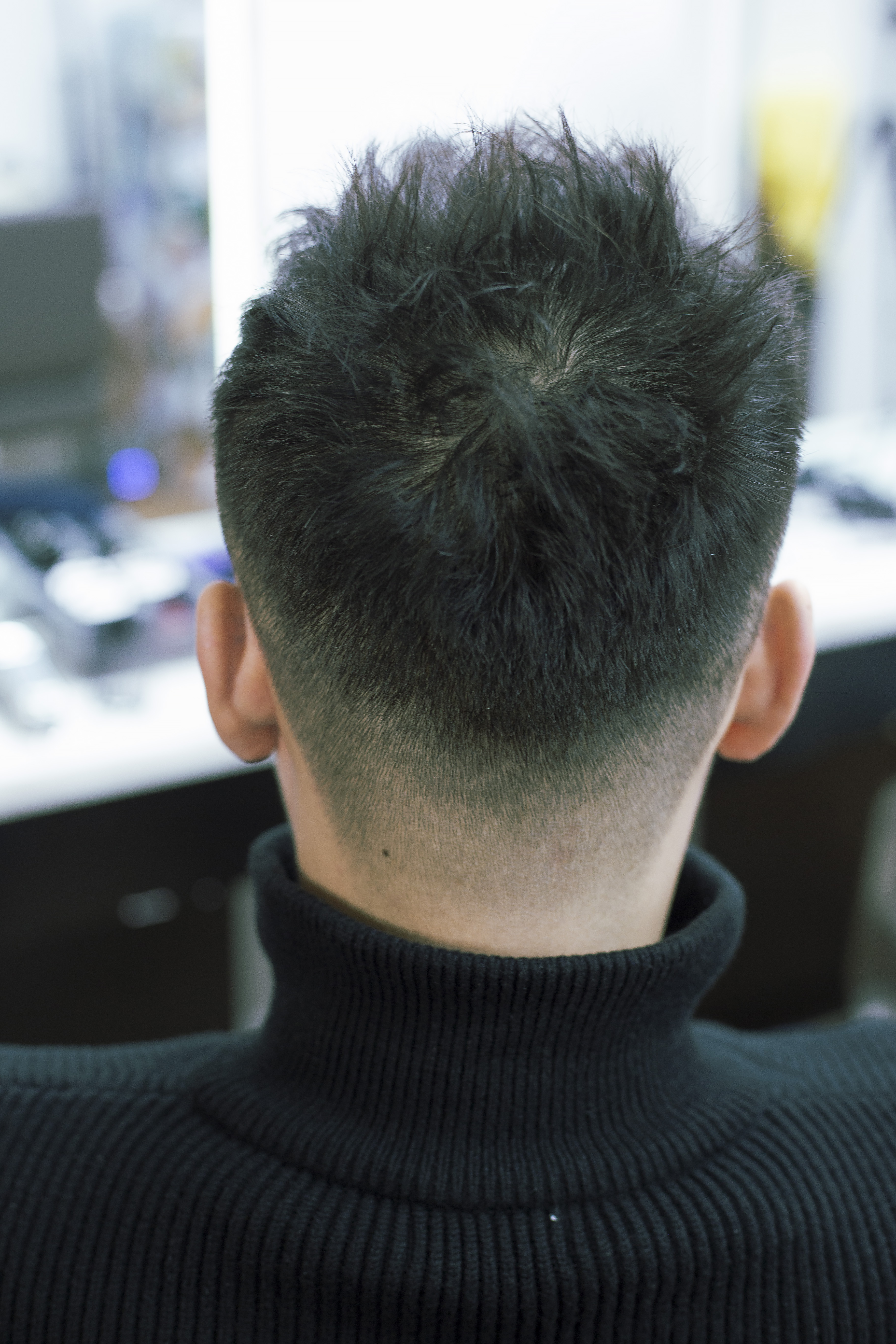 高发际线发量稀疏发型,发际线高头发稀疏掉头发怎么拯救