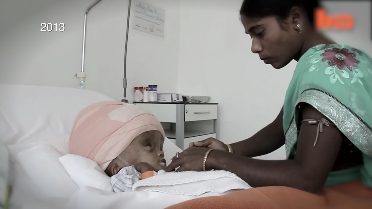 世界上身体部位最奇特的五个人,世界上身体最长的一个部位