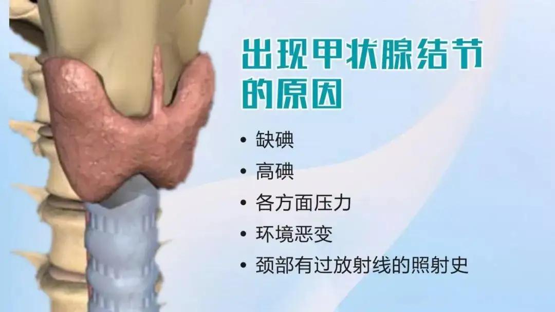 甲状腺结节的诊断与治疗,甲状腺结节的诊断与处理原则