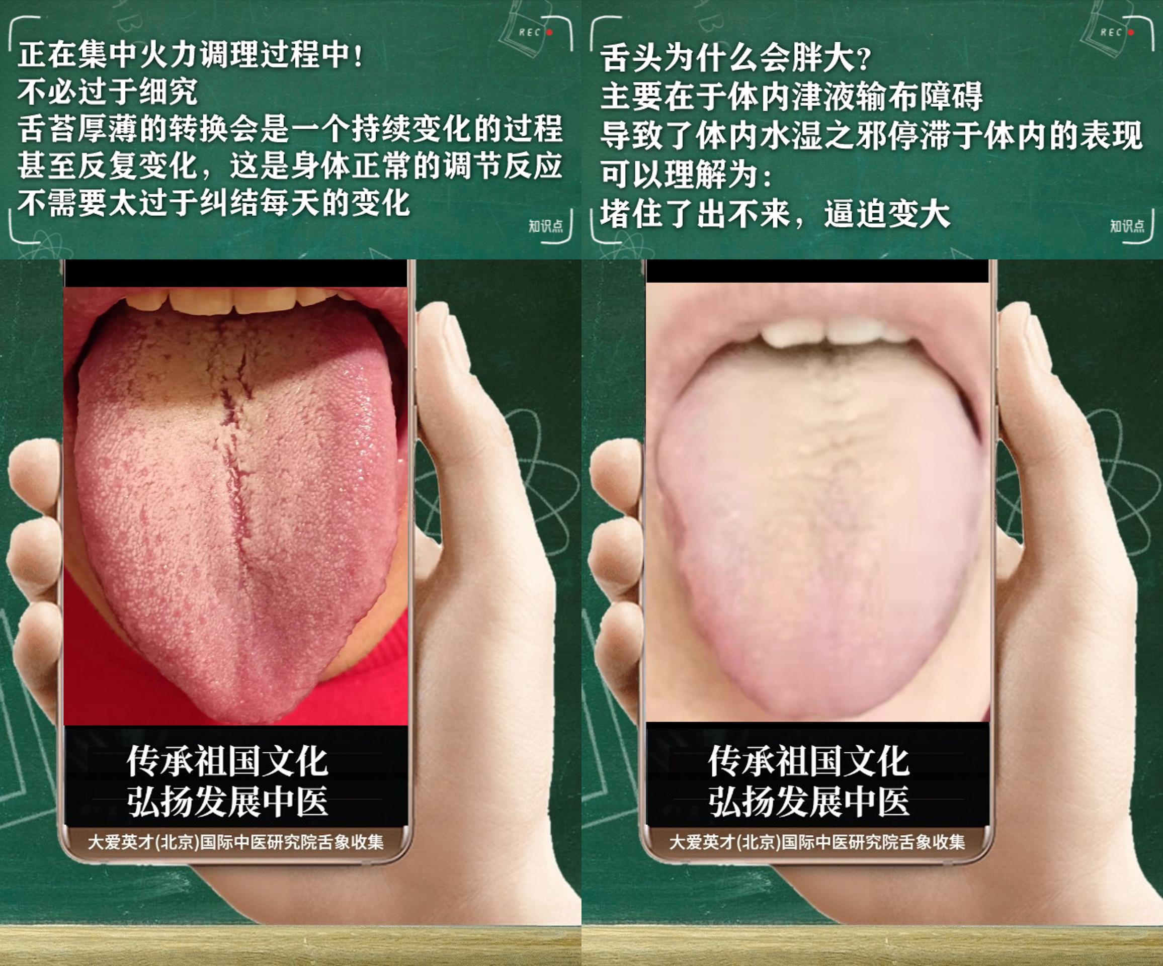 嗜睡肢冷鼻塞中医辨证,中医讲解感冒手脚冰凉