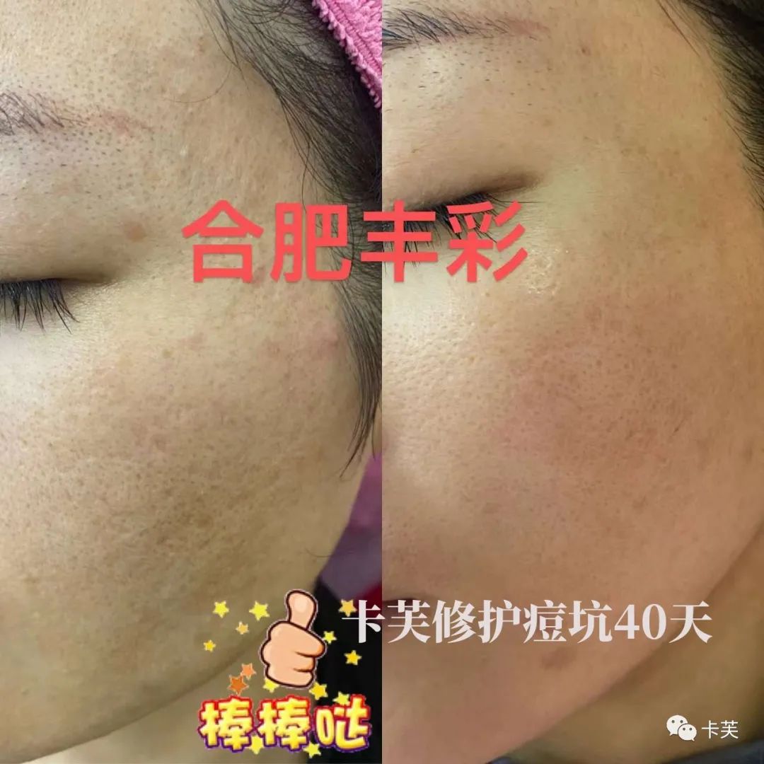 地龙多肽多效美肤霜，赋予你应有的健康、美丽与自信