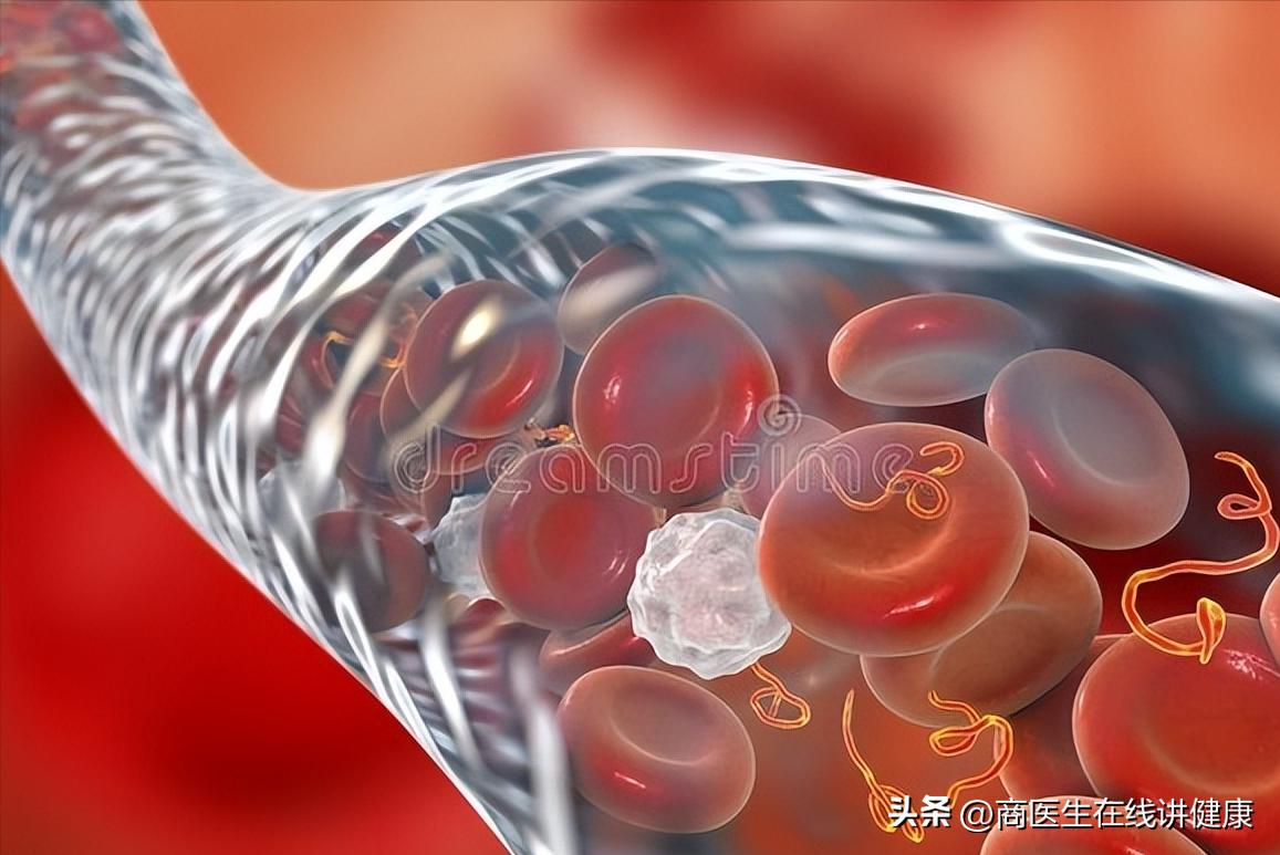 血糖看脚部六个变化,血糖高看脚什么意思