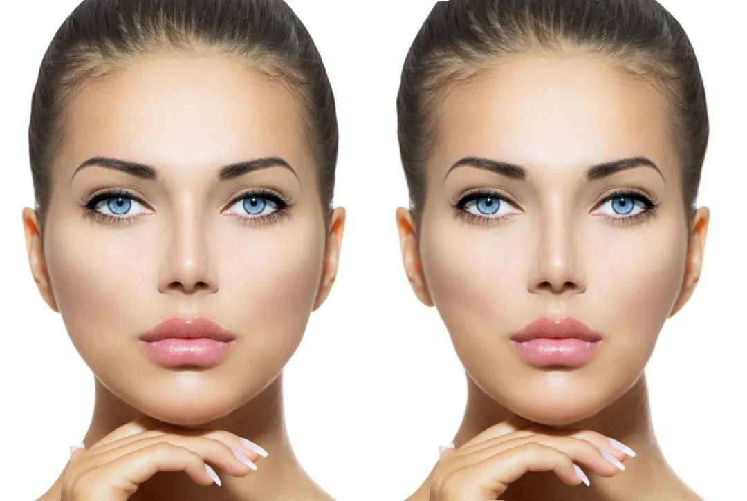 中年人正畸后的后遗症,正畸都会有什么后遗症