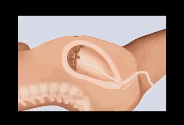 女人生孩子全过程曝光（漫画）