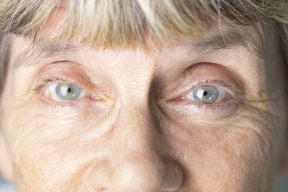 减少皱纹的坏习惯,造成脸部皱纹疯长的坏习惯有哪些