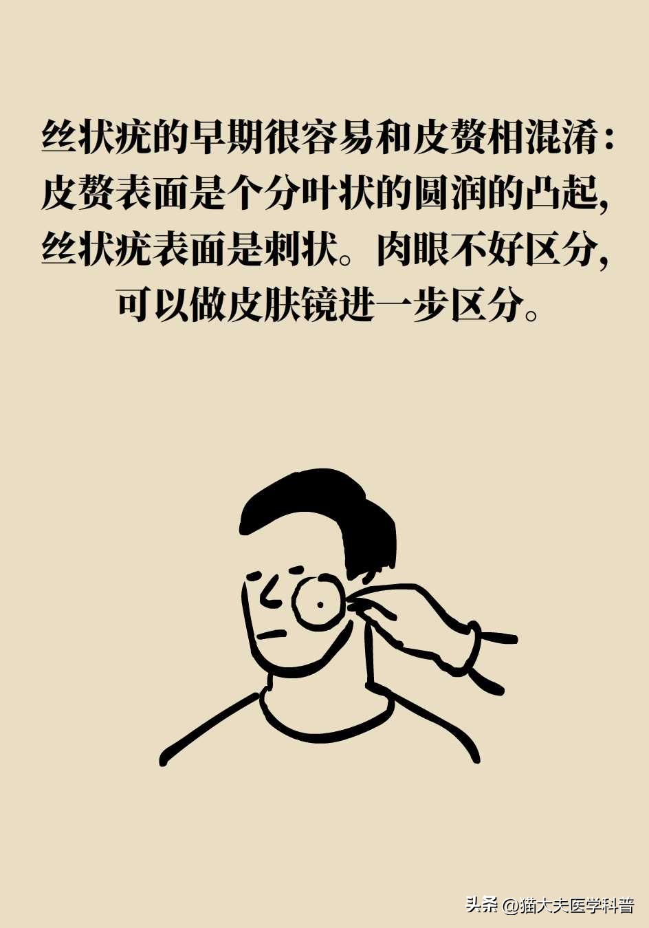 脖子上长的小肉揪怎么治啊,疣丝是不是脖子上的小肉粒