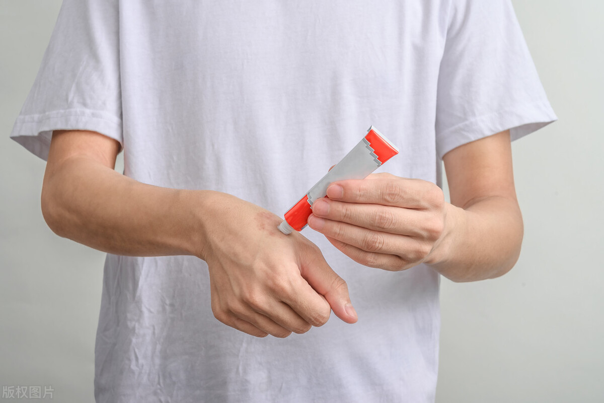 身上长不规则褐色斑怎么去掉,突然长褐色斑是怎么回事