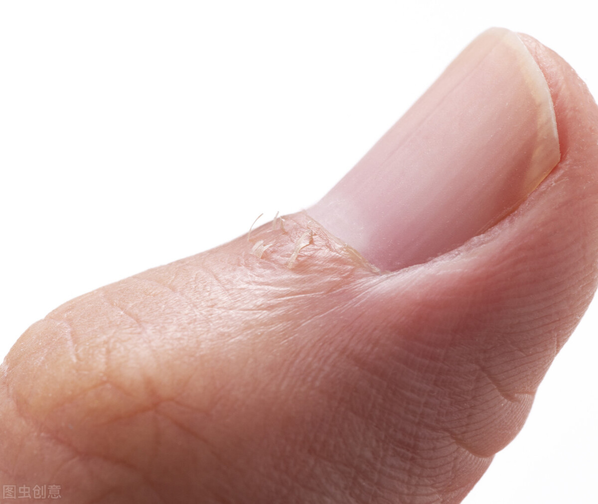 红霉素软膏可以涂眼部吗,红霉素软膏涂眼睛的副作用