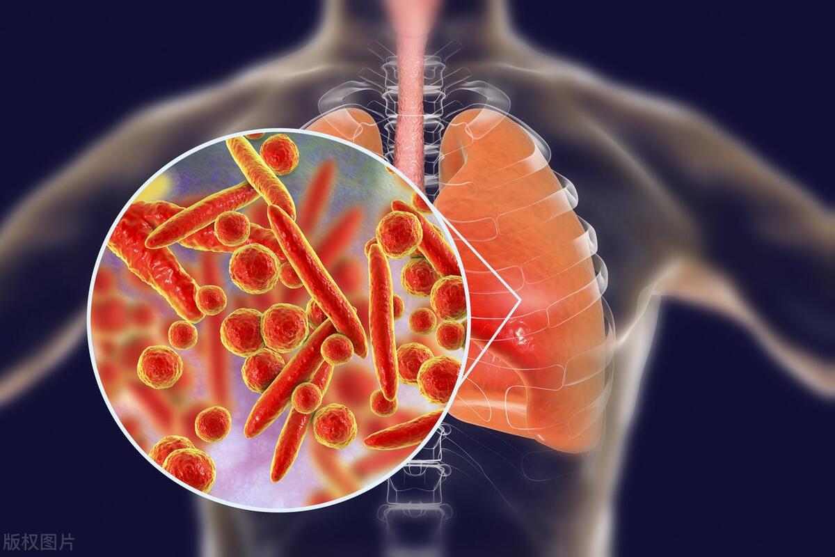 阿莫西林：被误解太久了！只对6种病有效，用错引祸上身