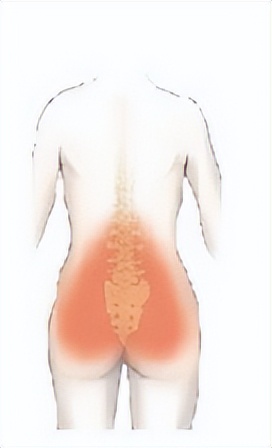 腰痛原因讲解,腰痛康复科普文章内容