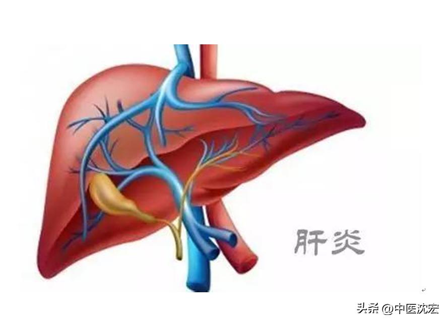 肝不好喝什么药养肝护肝,肝不好护肝的药品