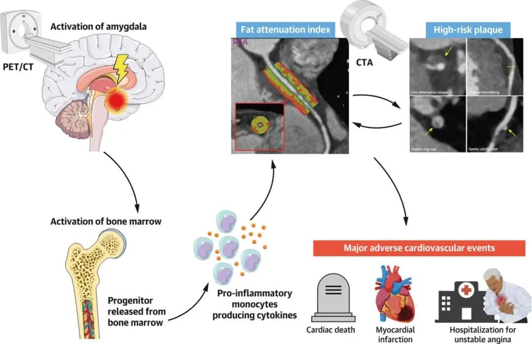 因为生气导致的心脏问题都有什么,经常生气会导致的心脏问题