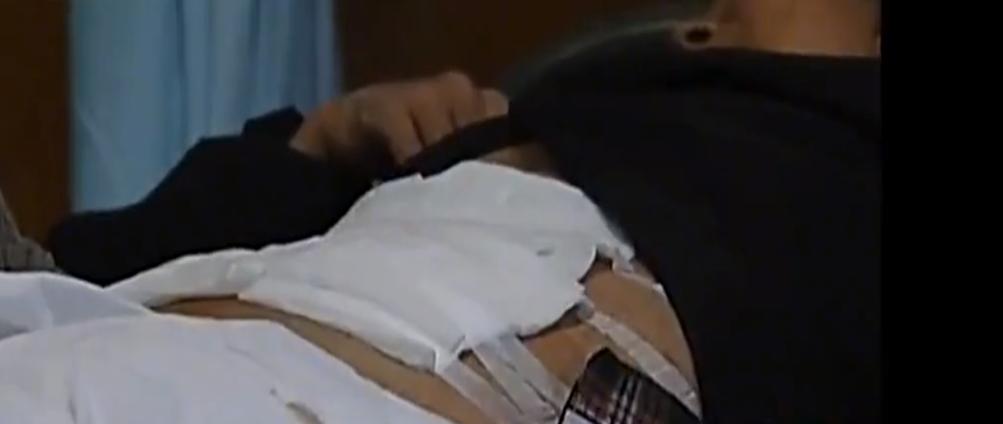 重庆一妇女肚子巨大,女子肚大如球竟是5颗肿瘤