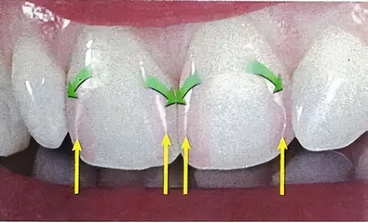 艾优和飞利浦儿童电动牙刷测评,飞利浦和usmile儿童电动牙刷测评