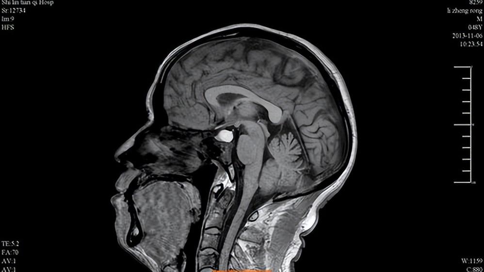 闭经是不是指一直没来,为何女性容易出现月经不调的问题