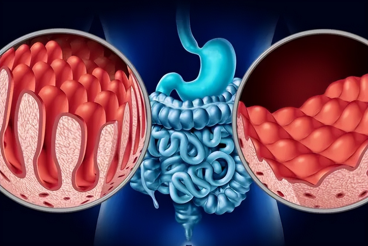 阿莫西林是好药但别乱吃,阿莫西林别乱吃只对这四种病有效