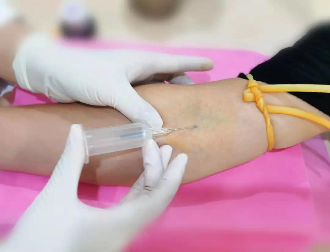 怎么判断采血管溶血,抽血化验溶血需要重新抽怎么回事