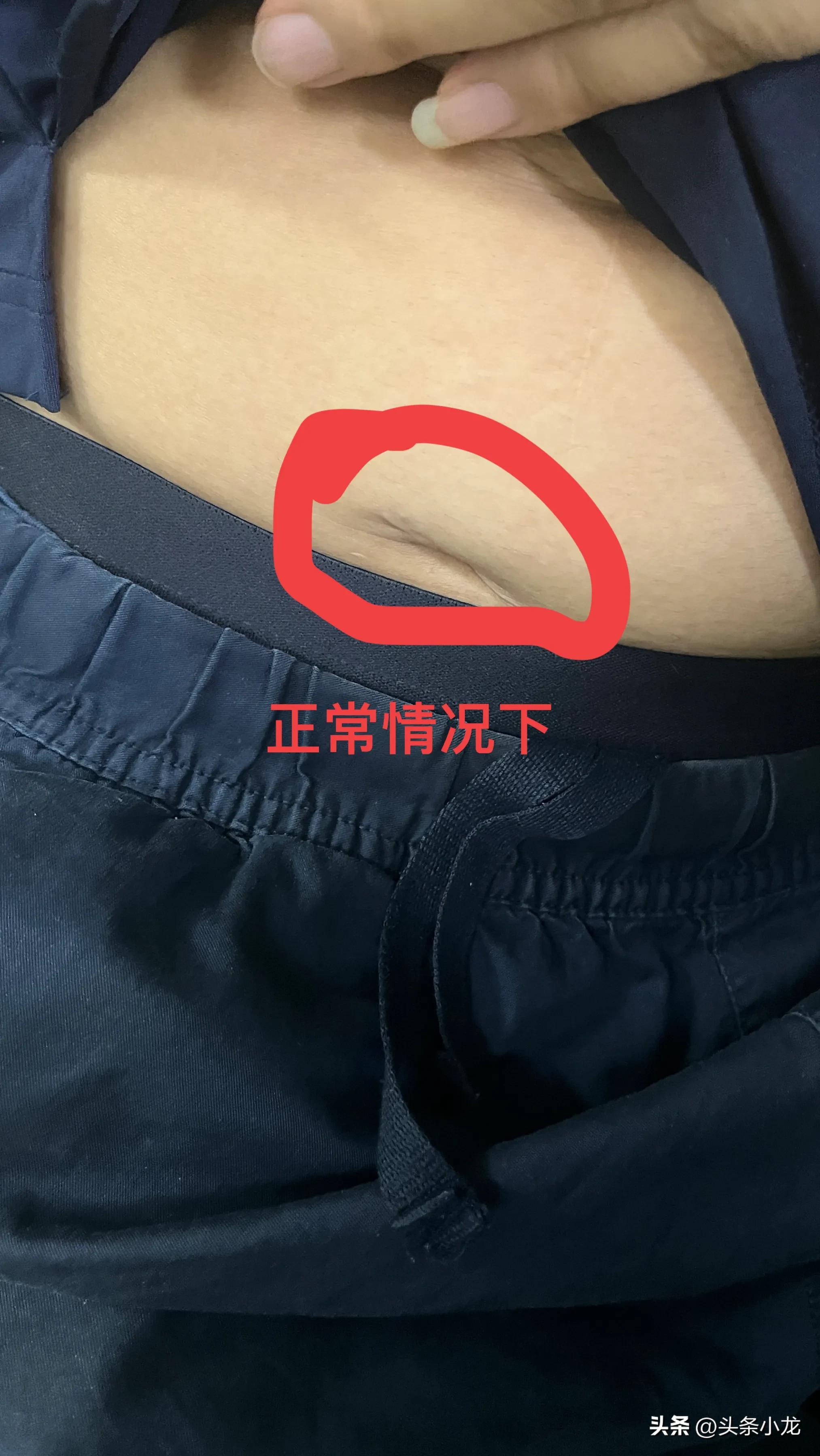 生平两次遇到比较坑的医院都是在东莞长安