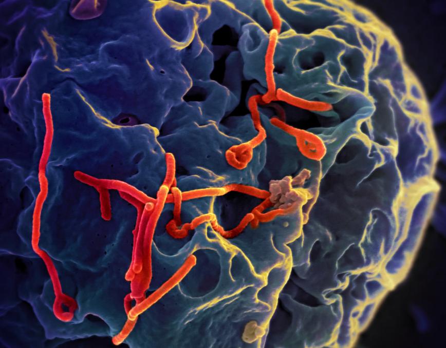 “安全套”上的油是什么？会对女性身体造成伤害吗？看完涨知识了