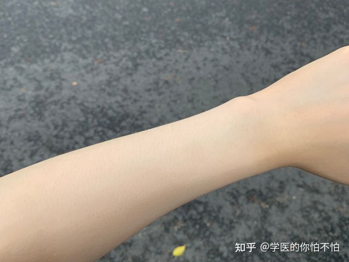 怎么快速变白,怎样让脸快速变白学生党