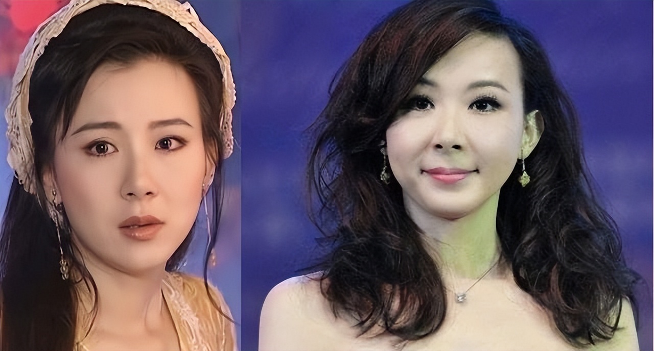 明星下颚骨整容后遗症,脸像鞋拔子怎么改善