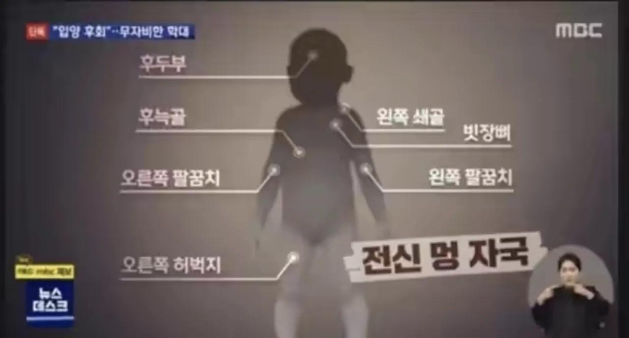 韩国虐待20个月孩子致死,韩国父母虐待孩子