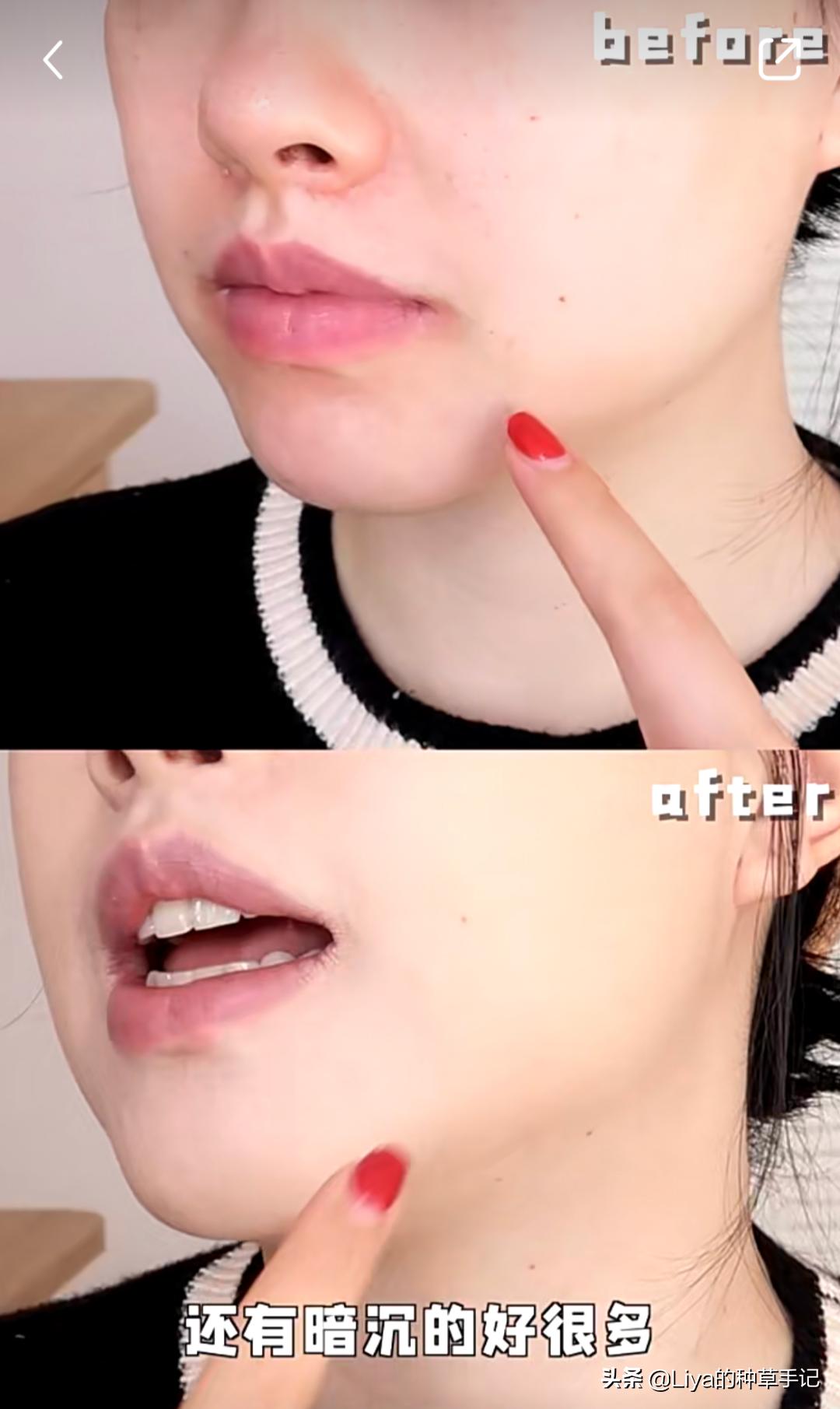 扁平脸如何拯救,扁平脸修复方法图解