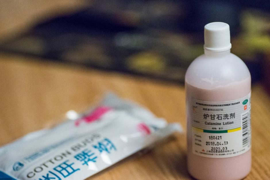 世卫组织推荐炉甘石,炉甘石洗剂哪个牌子的效果比较好