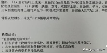 smarca-4缺陷型肺癌早期能手术吗,早期肺癌手术前一定要做petct吗