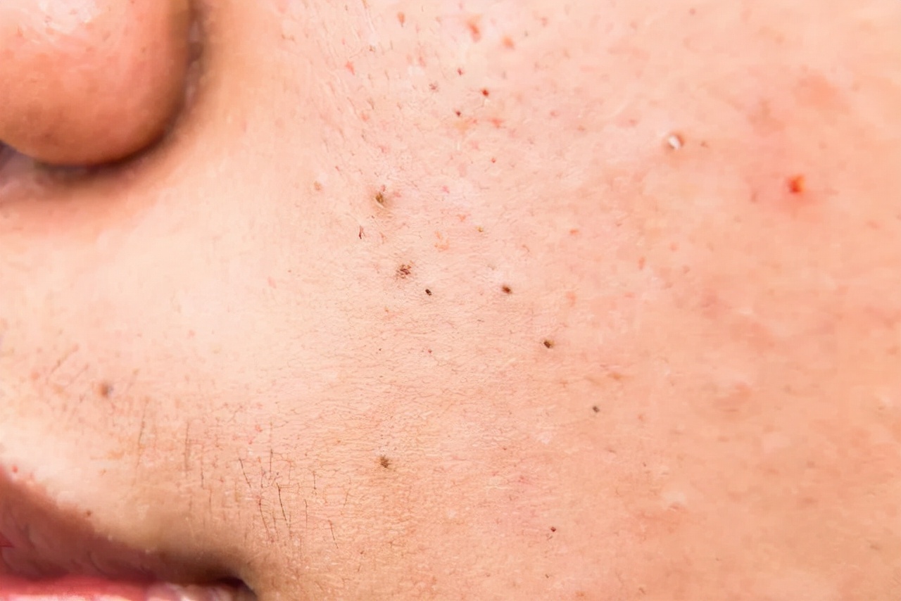 誓颜永恒美容怎么样,誓颜永恒阳春店