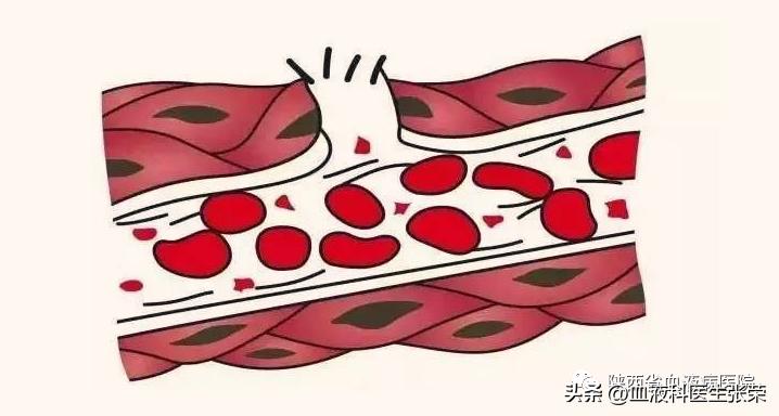 血小板低于50后果是什么,平均血小板体积偏低8.50正常吗