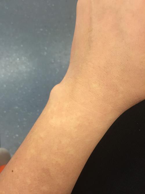 乘客坐公交摔骨折司机赔偿,乘客坠亡案司机获刑1年