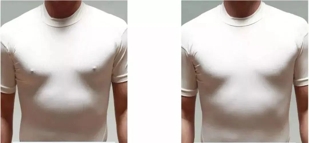 男性胸前两个点叫什么,男性胸前两个点