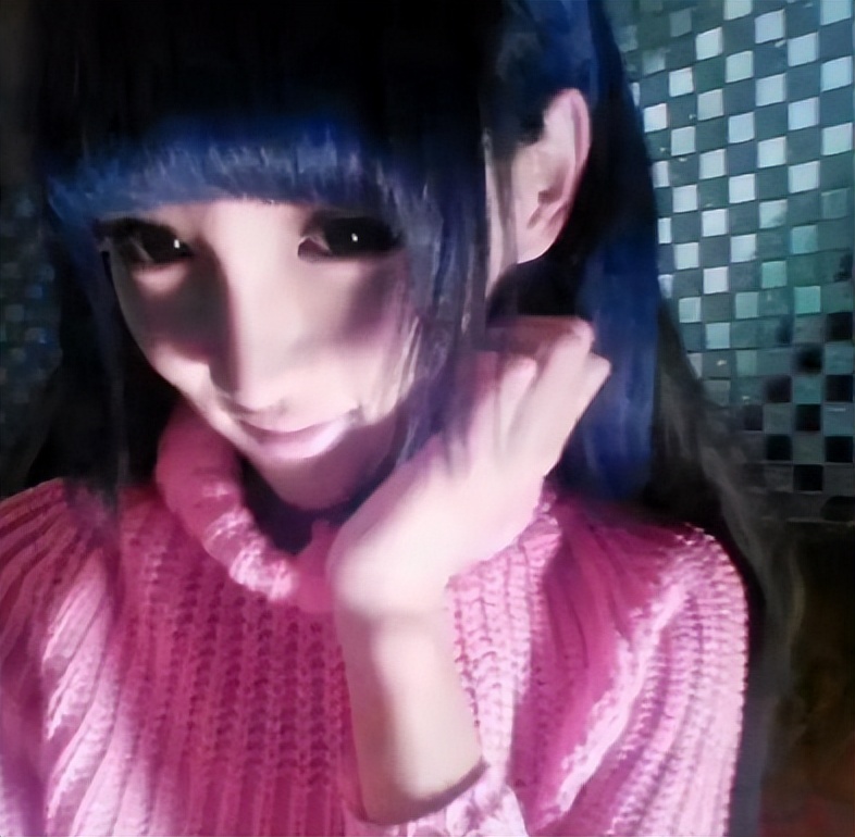 “桃花宝宝”迷恋整容，八年花费上百万，嘴歪眼斜额头出现大坑