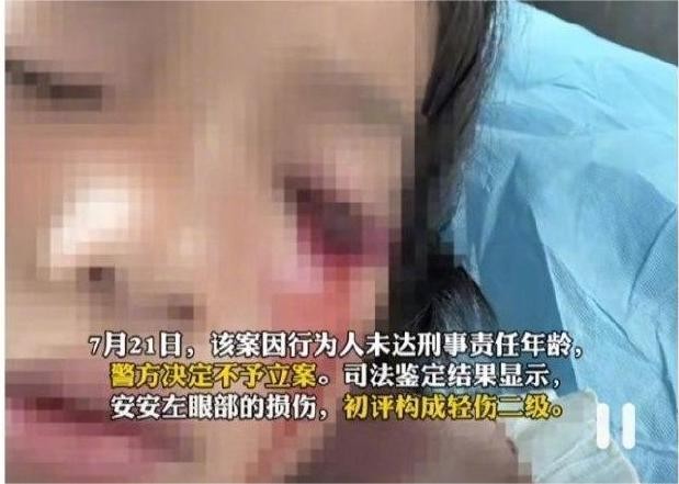 女童遭两少年用弹弓射伤后续,8岁女童被弹弓射伤失明专案组