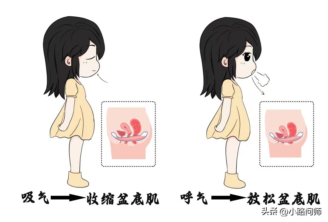 功法治疗压力性尿*禁失**