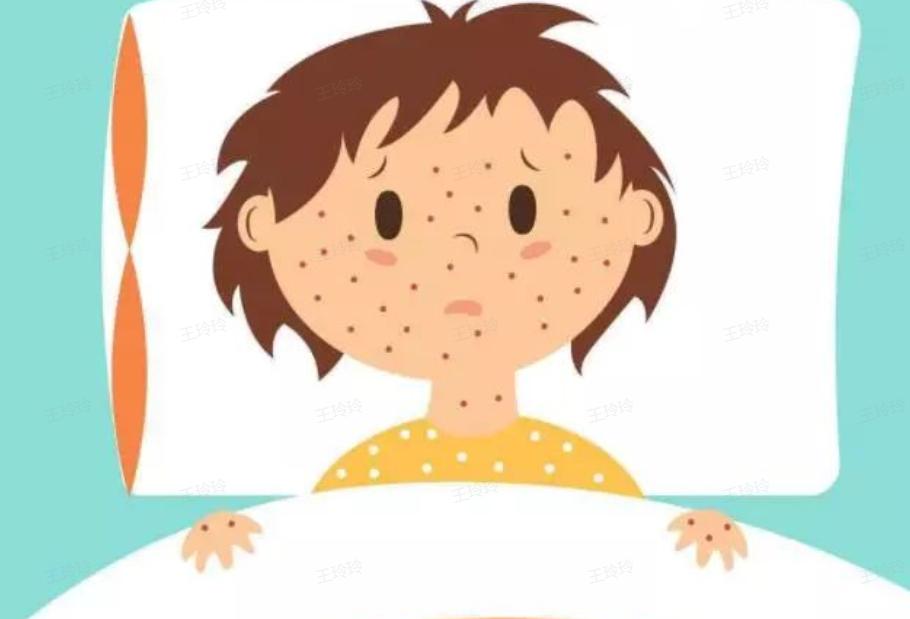 学校水痘爆发的防控措施,学校水痘感染防治要求