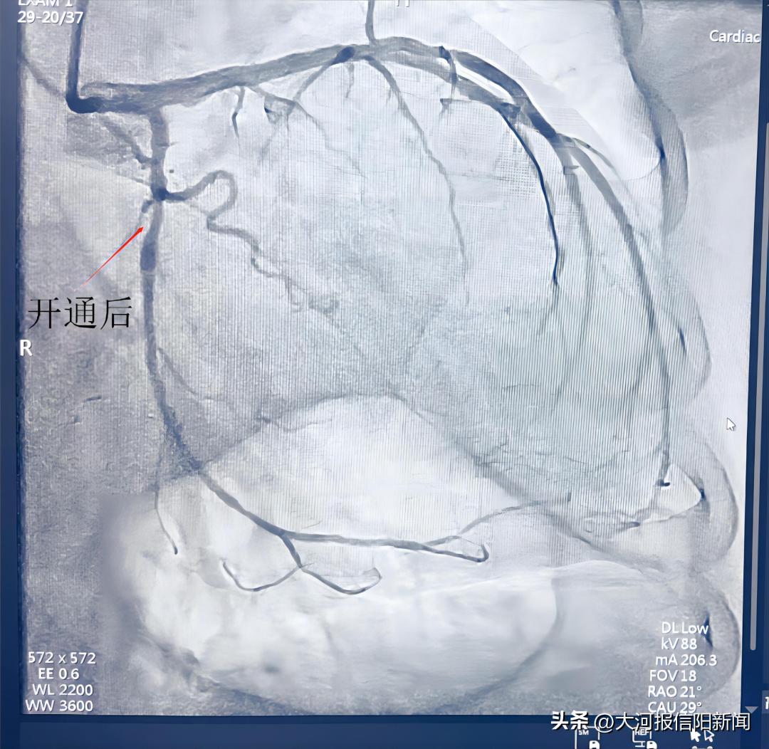 信阳医院手术室及病房净化,信阳中心医院手术室
