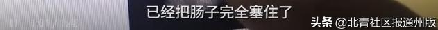 一小孩误食磁力球,幼童误食28颗磁力珠被救