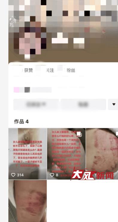 女孩留宿同事家被爸爸打抖音,女孩被同学打的耳穿孔