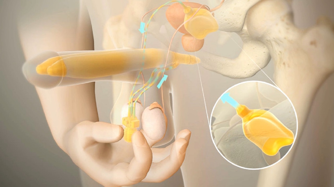服用伟哥后停药后不如从前怎么办,对伟哥的抗药性通过停药会缓解吗