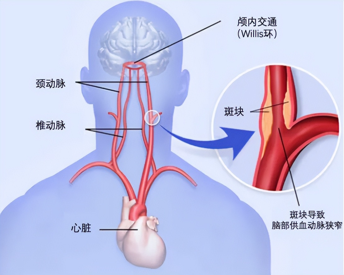 冠心病诊断预测模型,建模预测冠心病