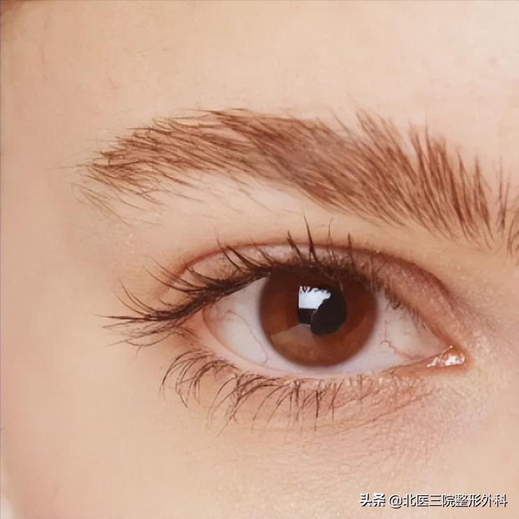 双眼皮面诊是咨询师还是手术医生,双眼皮当天面诊当天做影响效果吗