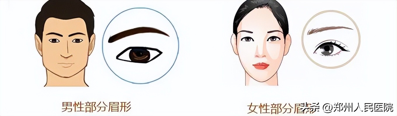 种植眉毛有哪些方法图,怎么种植眉毛效果最好