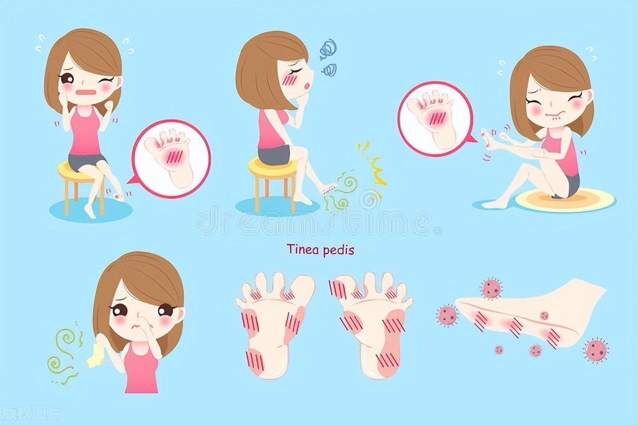 足部皮肤皲裂图片,足部皲裂和足癣怎么区分