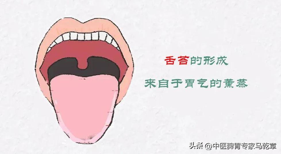 有萎缩性胃炎舌苔发黄是怎么回事,萎缩性胃炎舌苔表现
