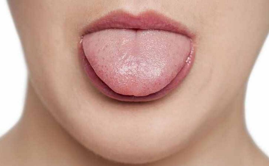 气虚出汗怕冷怎么调理,怕冷又爱出虚汗怎样调理