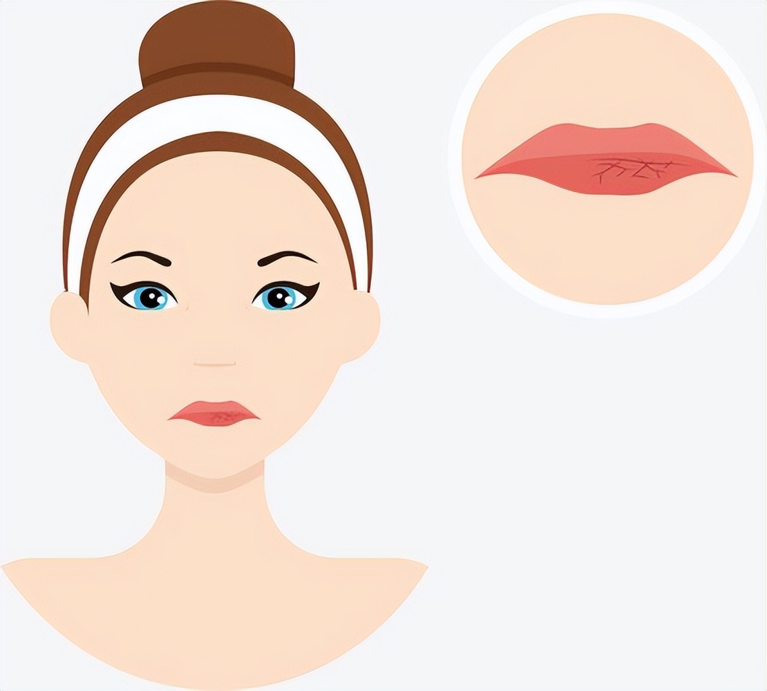 嘴唇干裂、脱皮的女孩看过来！给大家介绍几个护唇妙招