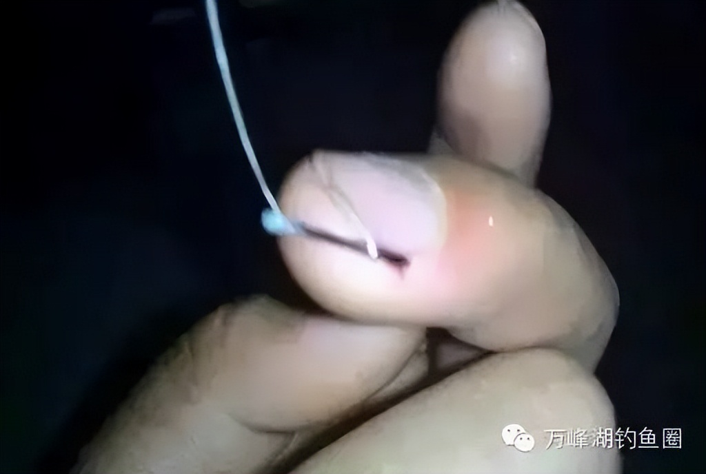 技巧：钓鱼引发流血事件，倒刺钩挂手处理办法